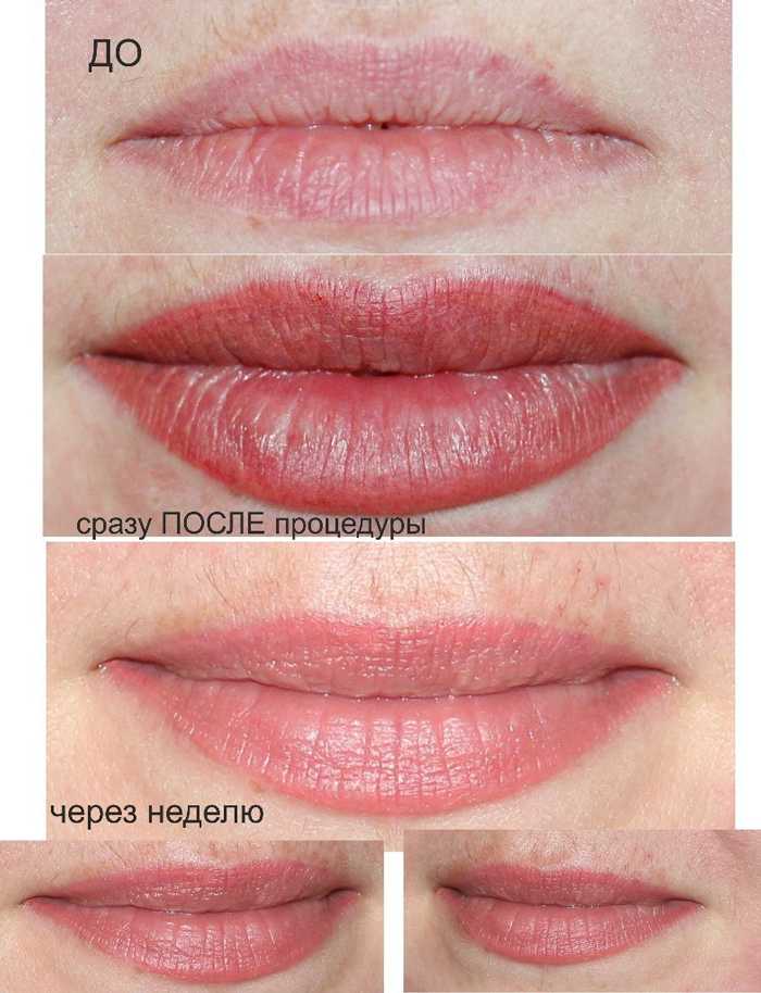 Вы узнаете как перманентный макияж губ поможет сделать черты вашего лица ещё более выразительными и запоминающимися Фото до и после процедуры