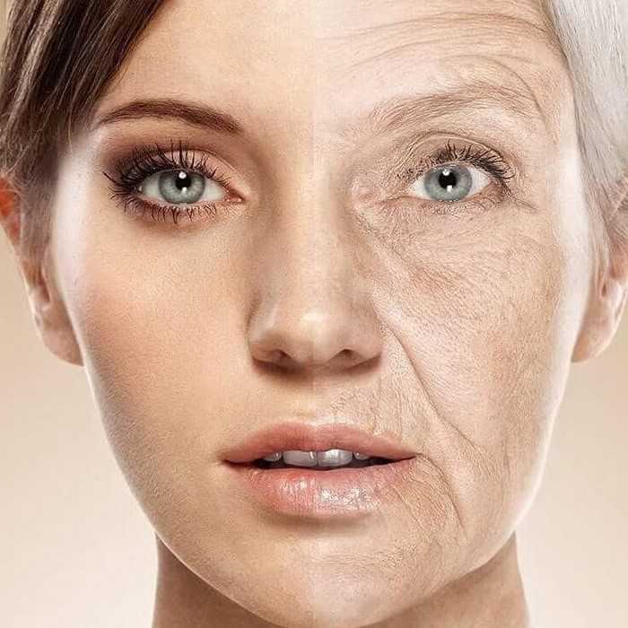 Расширенные поры на лице: причины и способы лечения