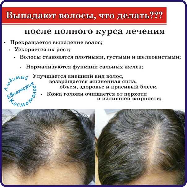 Аптечные средства против выпадения волос