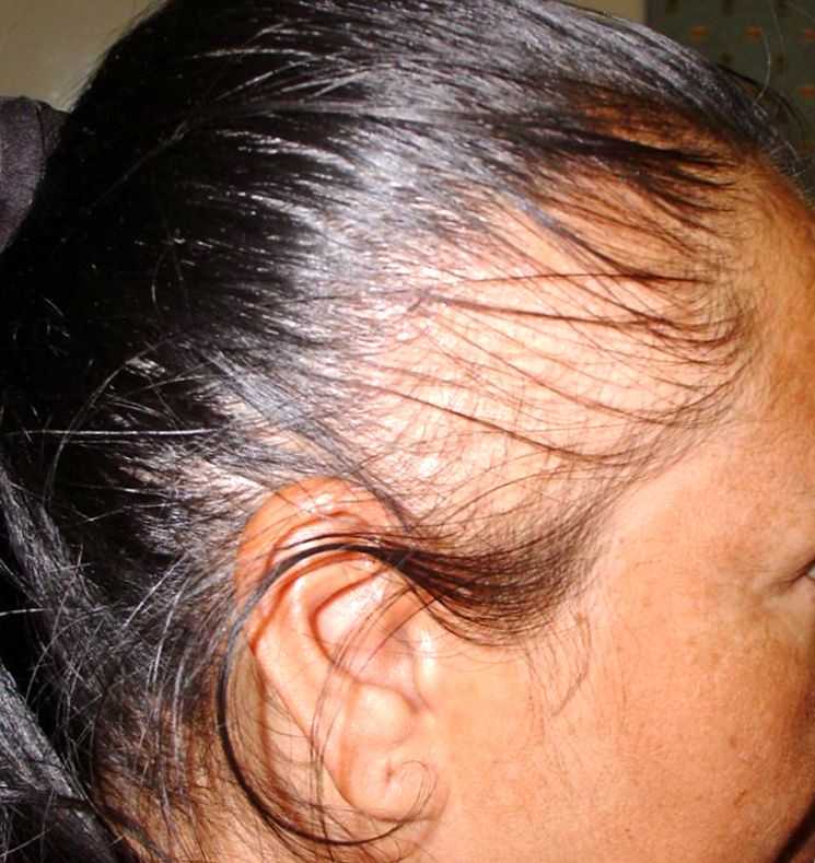 Правильный уход за сухими и поврежденными волосами в домашних условиях