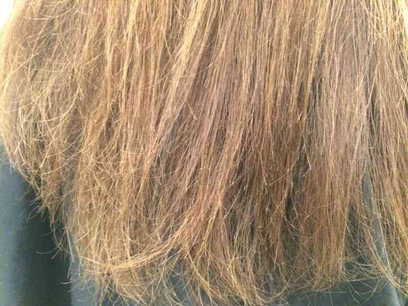 Секущиеся волосы: причины, симптомы, диагностика и лечение