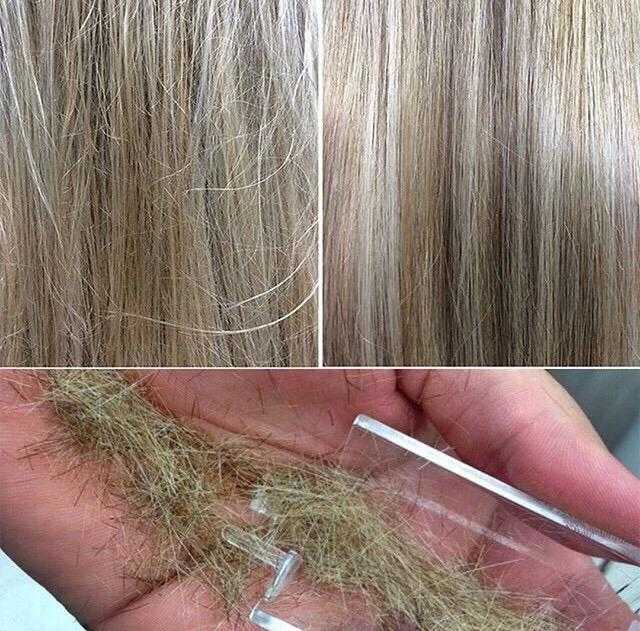 Современные методы лечения волос