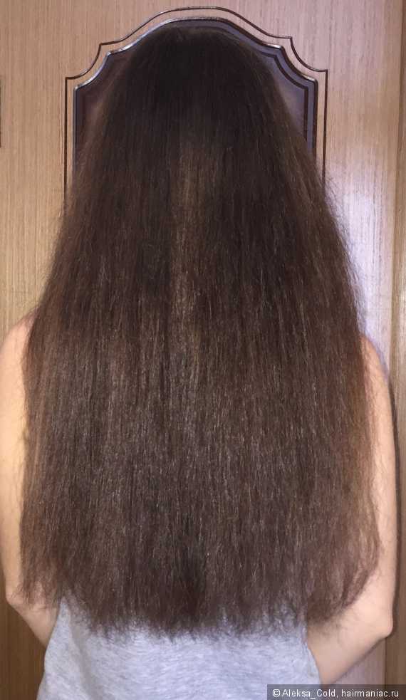Выпадение волос: причины, профилактика и лечение
